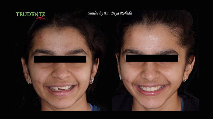 before-after1