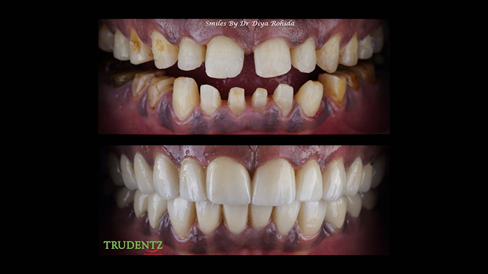 before-after3