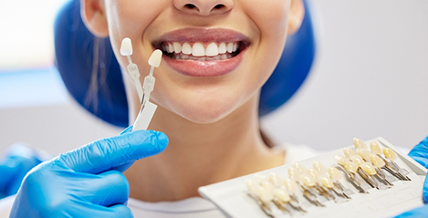 Smile Makeovers / Veneers