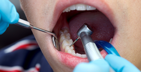 Biomimetic Restorative Dentistry